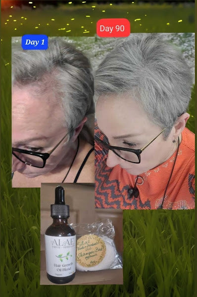 Anti-Balding Hair Oil