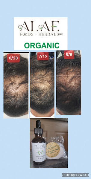 Anti-Balding Hair Oil