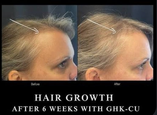 GHK-CU Hair Growth Duo